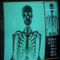 human skeleton x-ray